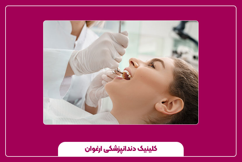 بررسی عوارض عصب‌ کشی دندان