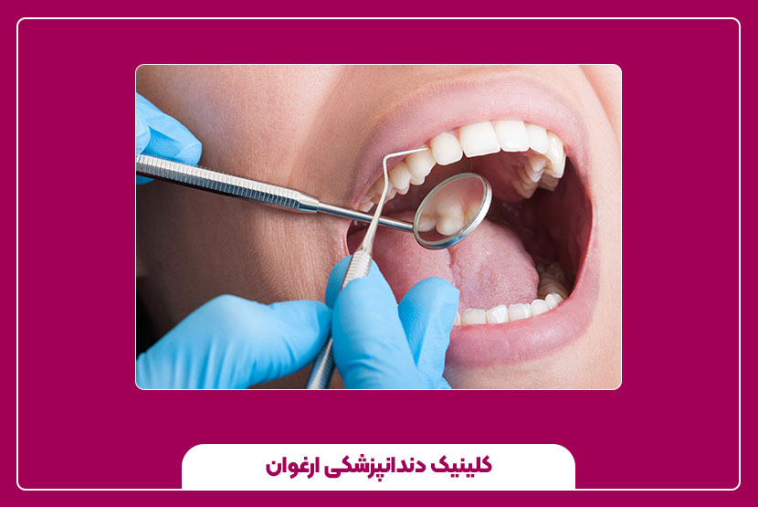 عصب‌ کشی دندان چیست؟