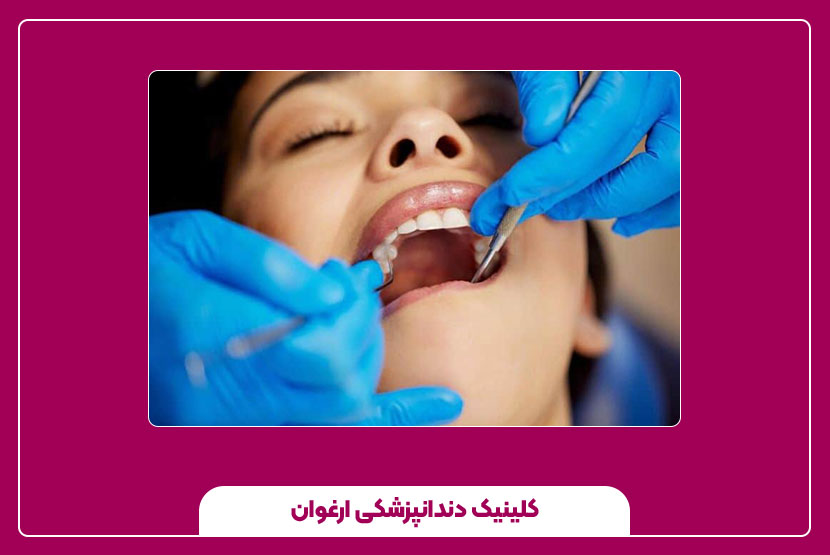 وسایل عصب کشی دندان