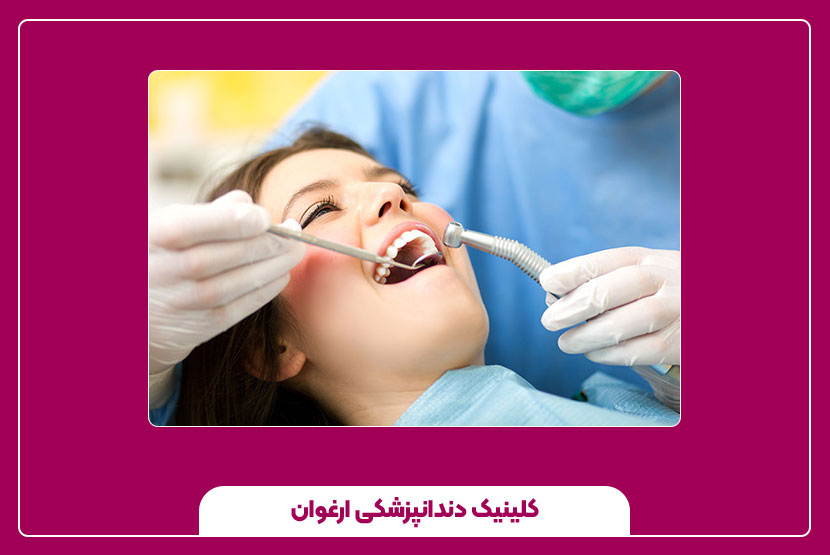 اندو دندان چیست؟