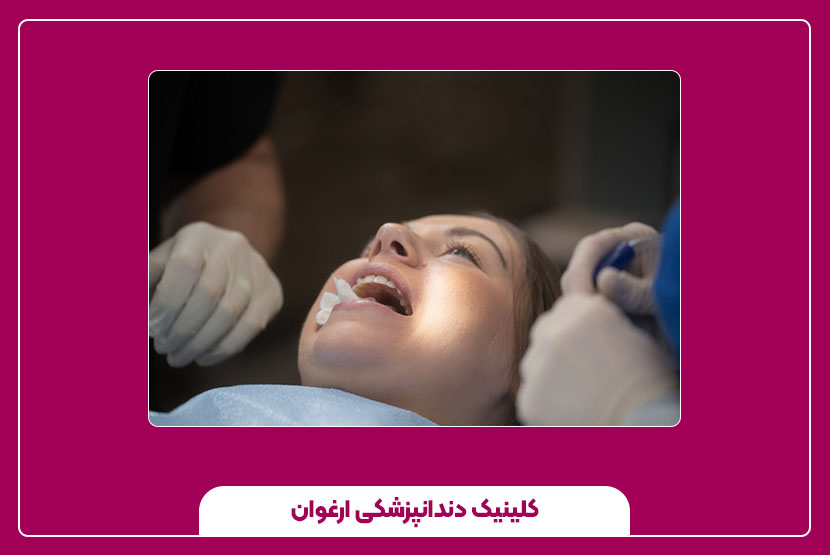 مراحل جراحی دندان عقل