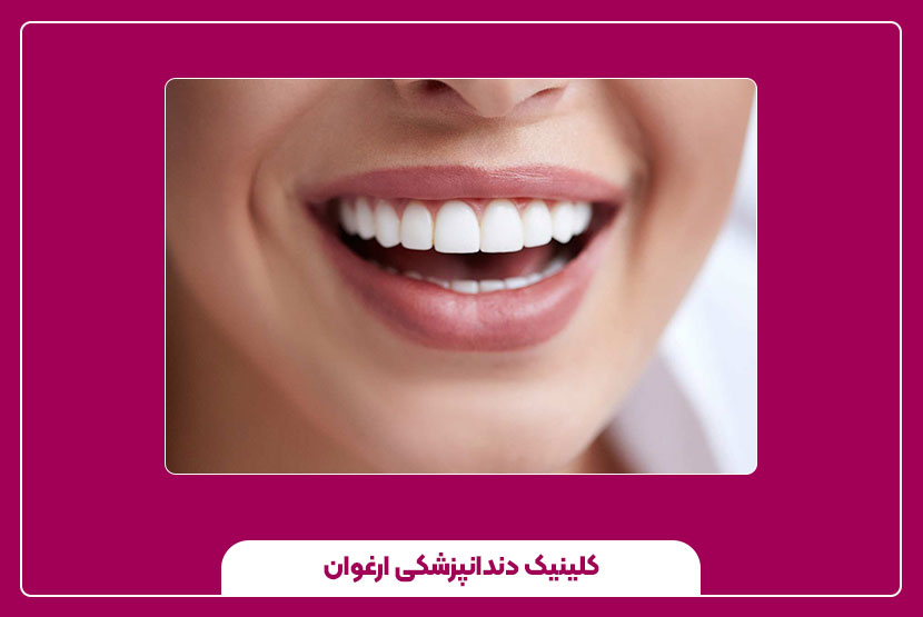 اصلاح طرح لبخند در دندانپزشکی زیبایی