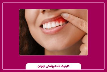 بهترین راه برای درمان عفونت دندان