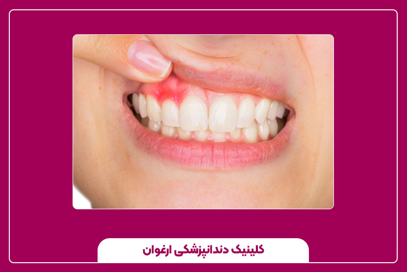 مراقبتهای خانگی در کنار درمان پزشکی