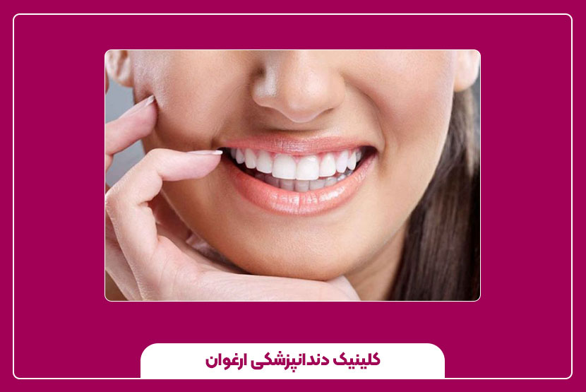 مراقبت‌های پس از بلیچینگ