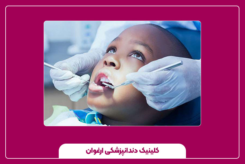 عصب کشی دندان کودک ۵ ساله