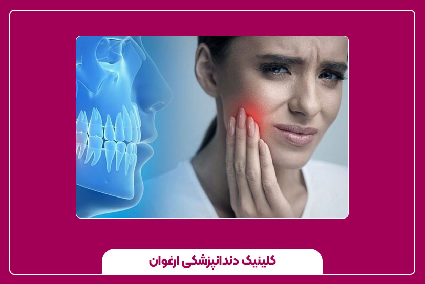 درمان گیاهی کیست ریشه دندان