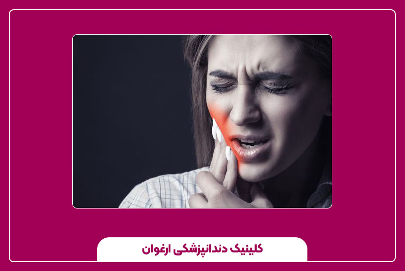 پیشگیری از کیست دندان