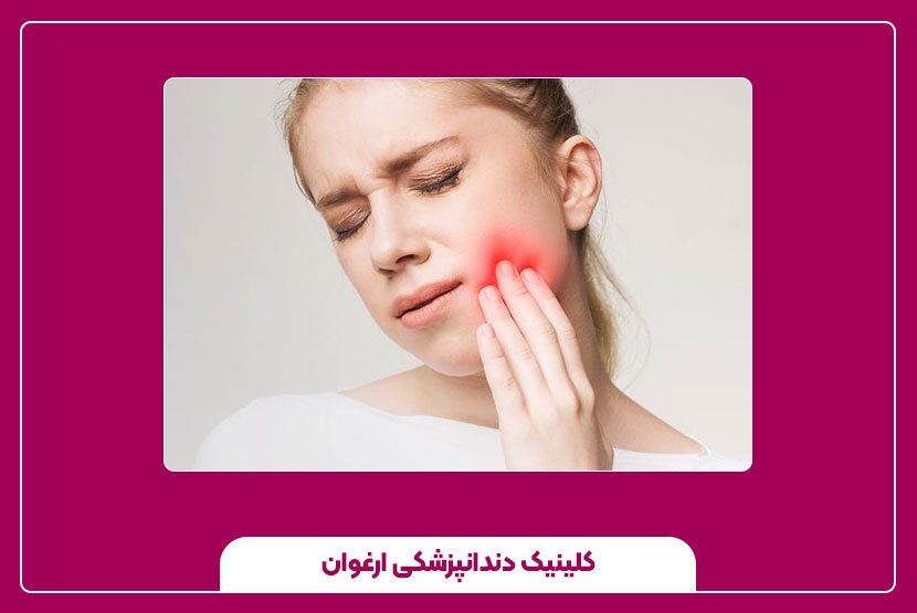 درمان کیست دندان در خانه