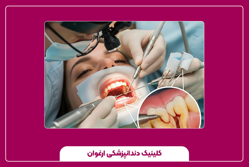 غذای مناسب برای بعد کشیدن دندان