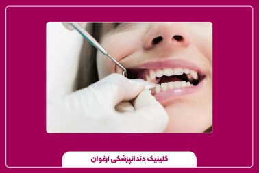 مراقبت‌های بعد از کشیدن دندان