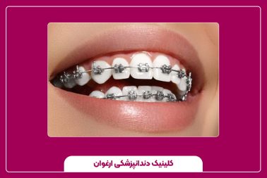 همه چیز درباره ارتودنسی