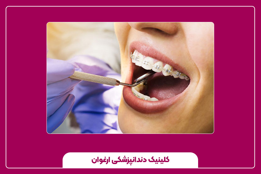 مراحل درمان ارتودنسی