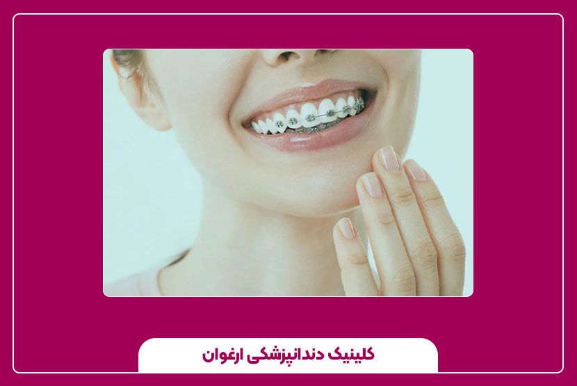 مراقبت‌ها، نگهداری و انتخاب کلینیک مناسب برای ارتودنسی