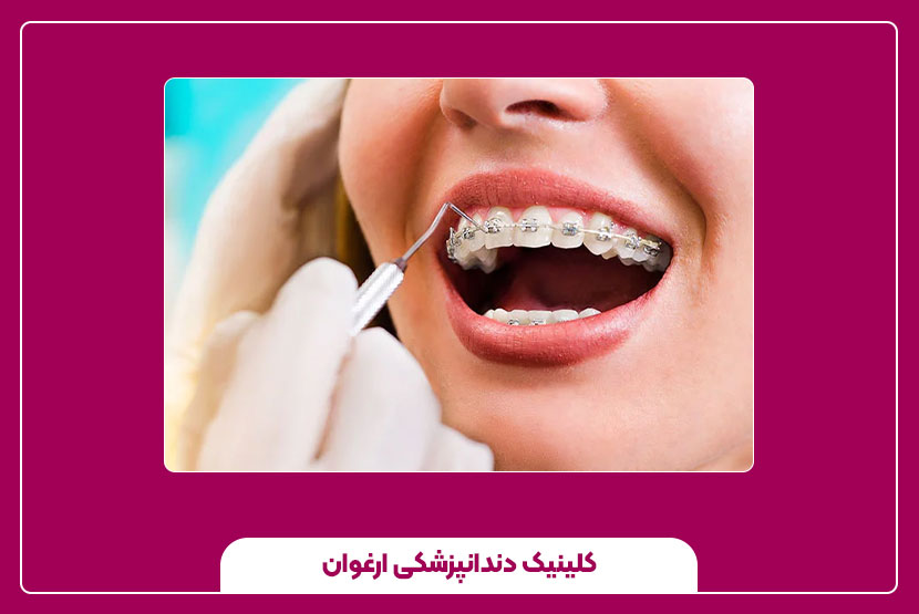 انتخاب کلینیک مناسب برای ارتودنسی