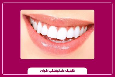 اصلاح طرح لبخند دندان