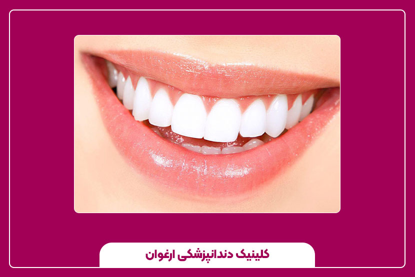 اصلاح طرح لبخند دندان