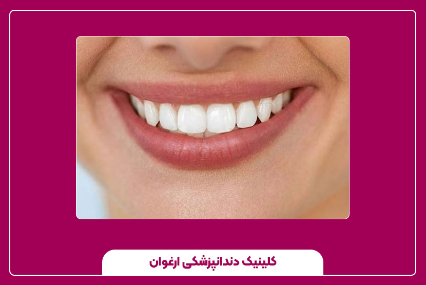 اصلاح طرح لبخند دندان