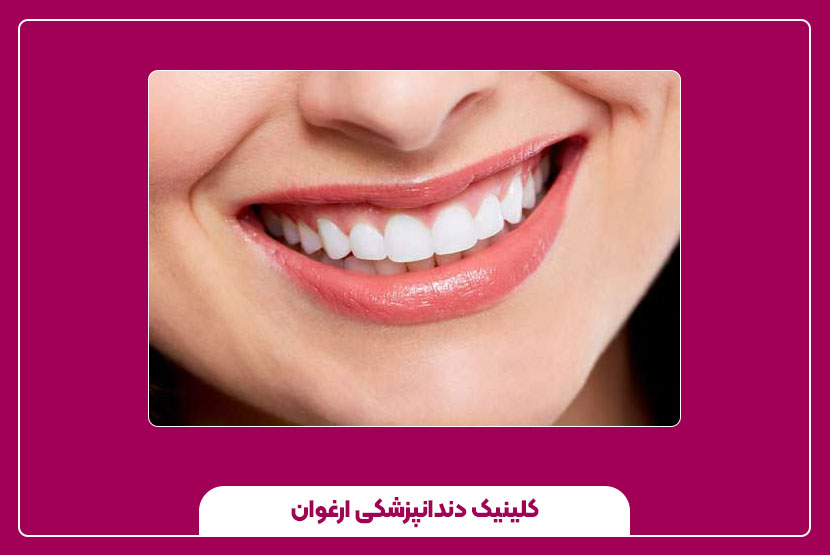 اصلاح طرح لبخند دندان