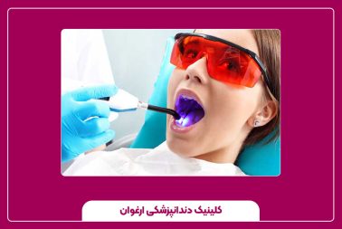 مزایای ترمیم دندان با لیزر