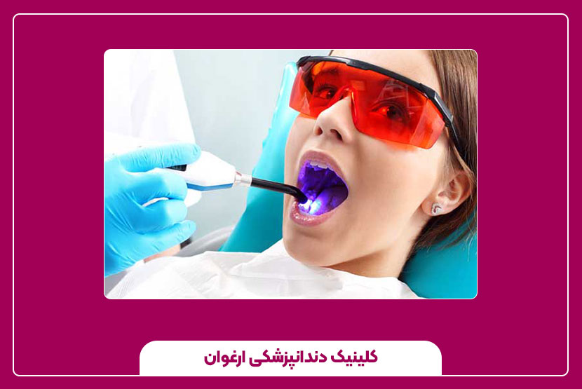 مزایای ترمیم دندان با لیزر