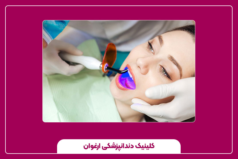 مزایای ترمیم دندان با لیزر؛ چرا لیزر بهتر از روش سنتی است؟