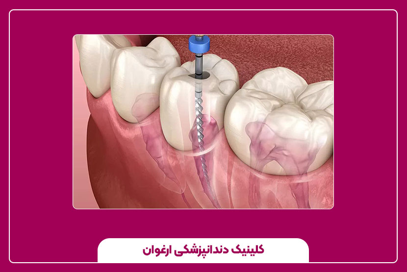 چه زمانی باید به دندانپزشک مراجعه کنیم؟