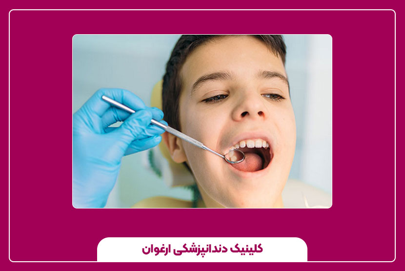 عوامل و شرایط نیاز به کشیدن دندان دائمی