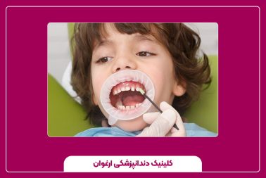 چه زمانی کشیدن دندان دائمی کودکان ضروری است؟