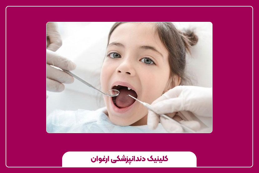 مراحل و روش‌های کشیدن دندان دائمی کودکان