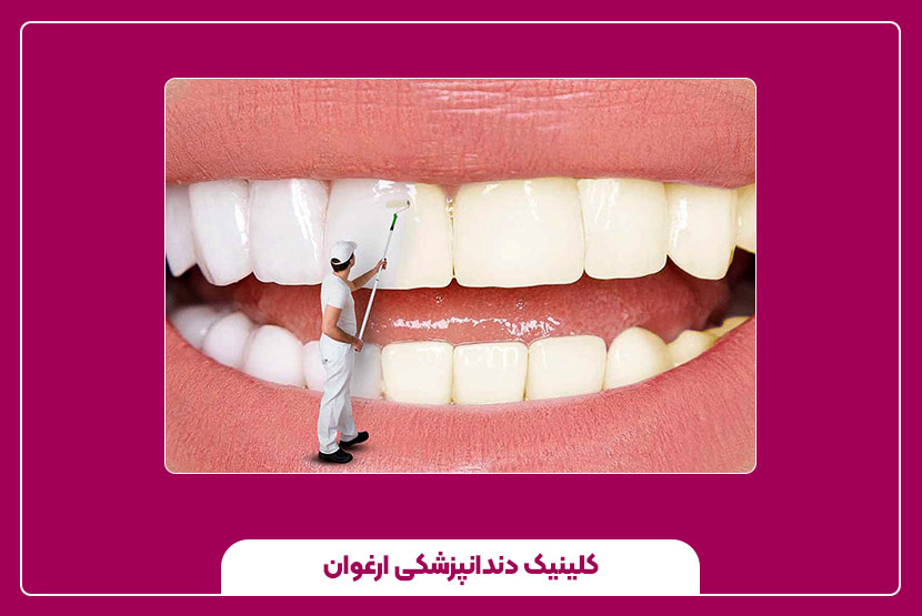 آیا بلیچینگ برای همه مناسب است؟