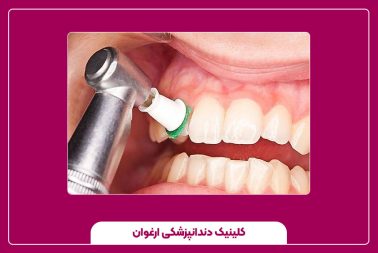هر چند وقت یکبار باید جرم‌گیری انجام داد؟