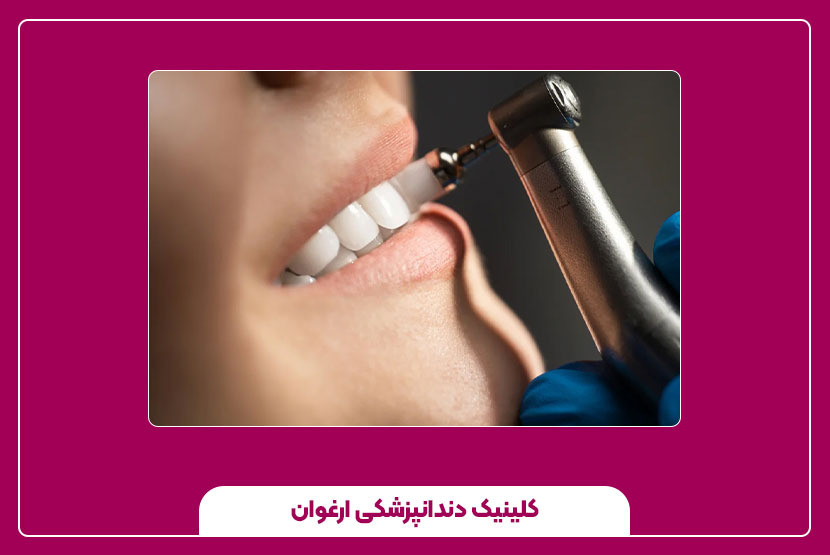 آیا جرم‌گیری زیاد برای دندان ضرر دارد؟