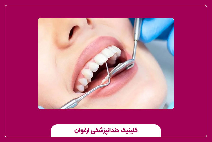 مزایا و معایب دندان‌پزشکی زیبایی