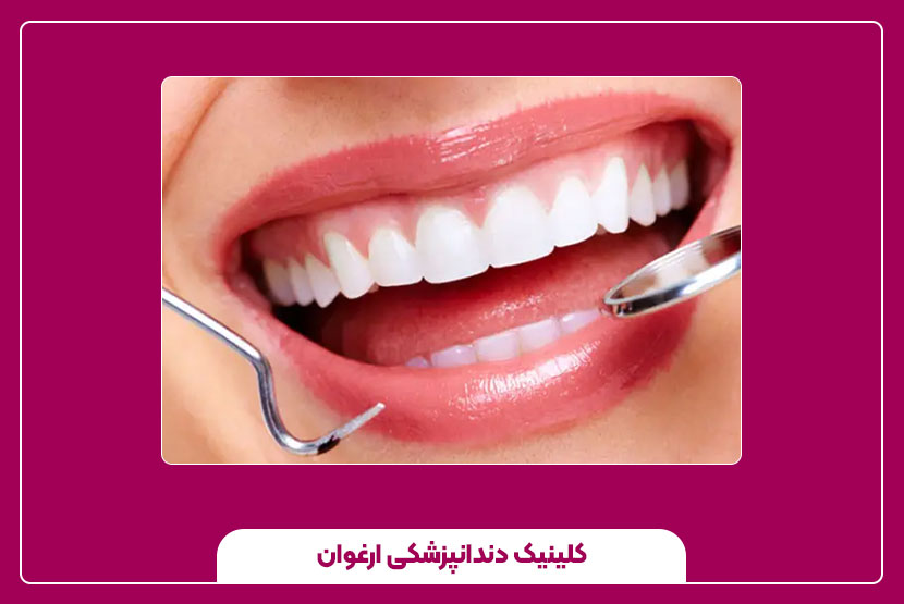 دندان پزشکی زیبایی شامل چه خدماتی است؟