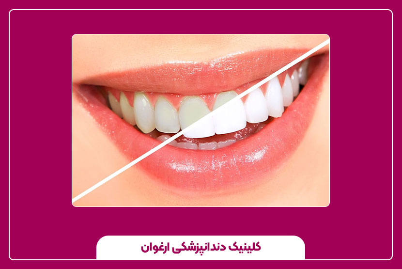 ماندگاری خدمات دندان‌پزشکی زیبایی