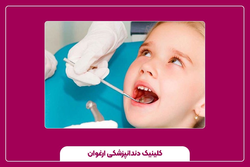 عوامل خرابی دندان کودکان