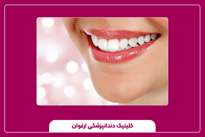 هزینه انجام ونیز کامپوزیت و عوامل تأثیرگذار بر آن