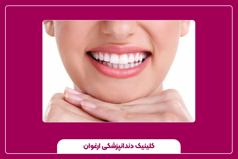 مراحل انجام ونیز کامپوزیت از معاینه تا تکمیل