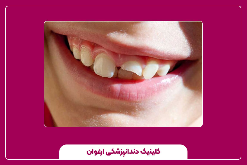 عوامل مرتبط با سلامت دهان و ساختار دندان