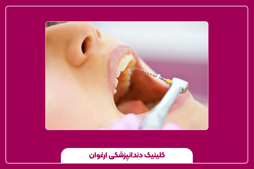 آیا عصب‌کشی دندان جلو زیبایی لبخند را تحت‌تأثیر قرار می‌دهد؟