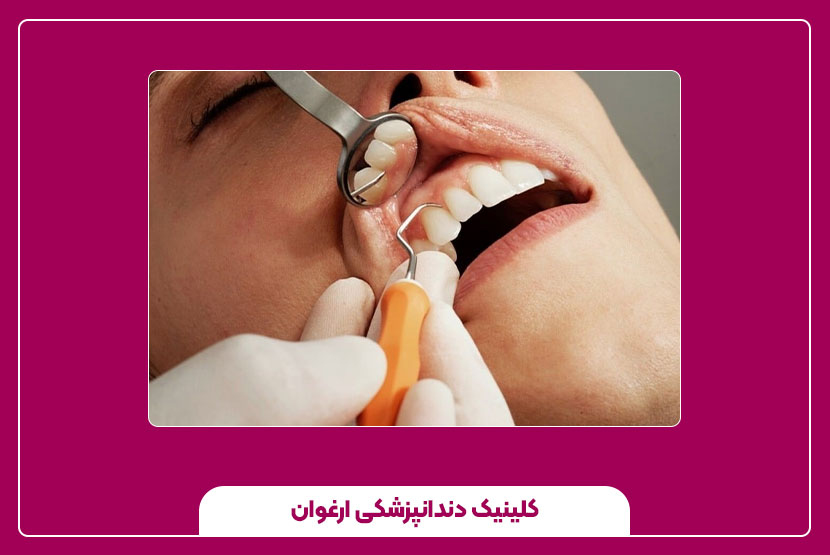 مراحل عصب‌ کشی دندان جلو چگونه است؟