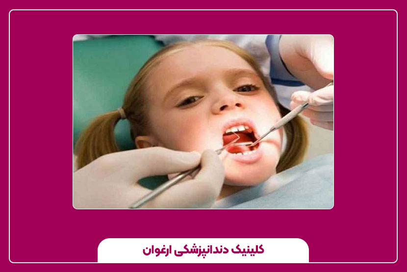 عصب‌کشی دندان کودکان