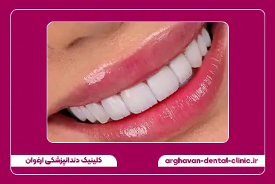 کامپوزیت بعد